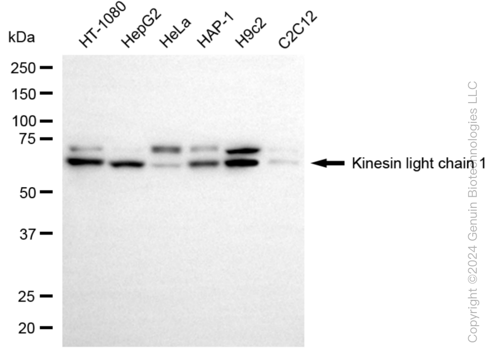 KLC1 Rabbit Monoclonal Antibody [Clone ID: 24GB6030]