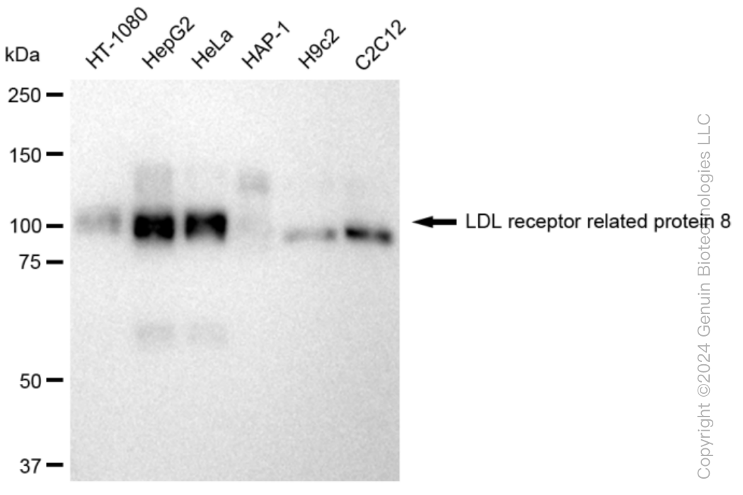 LRP8 Rabbit Monoclonal Antibody [Clone ID: 23GB2520]