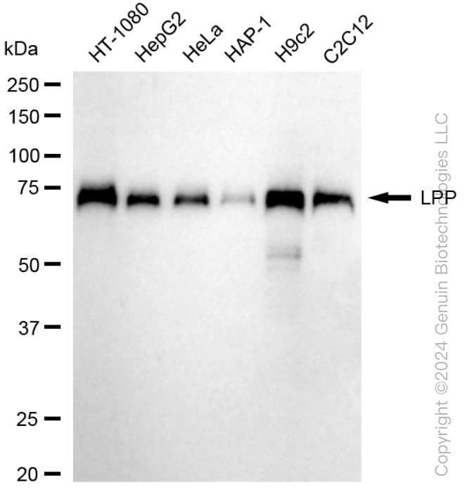 LPP Rabbit Monoclonal Antibody [Clone ID: 24GB05]