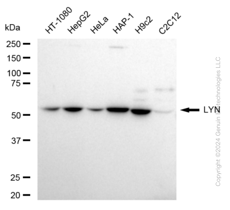 LYN Rabbit Monoclonal Antibody [Clone ID: 24GB720]