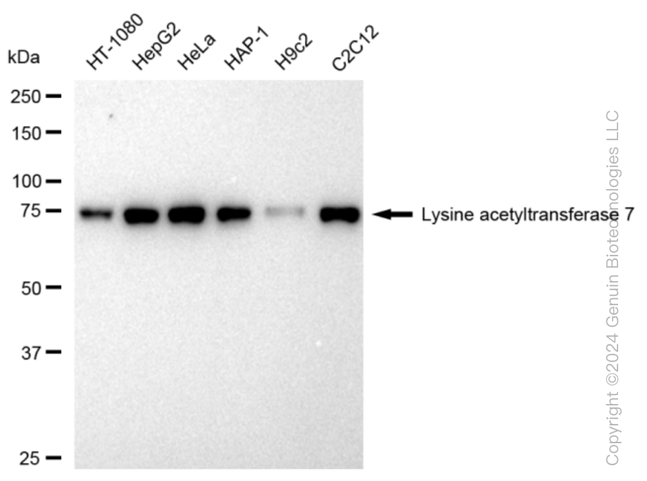 KAT7 Rabbit Monoclonal Antibody [Clone ID: 23GB2390]