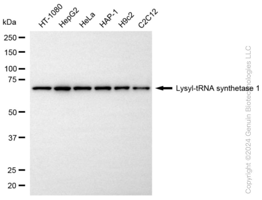 KARS1 Rabbit Monoclonal Antibody [Clone ID: 24GB6130]