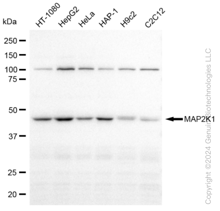 MAP2K1 Rabbit Monoclonal Antibody [Clone ID: 23GB2940]
