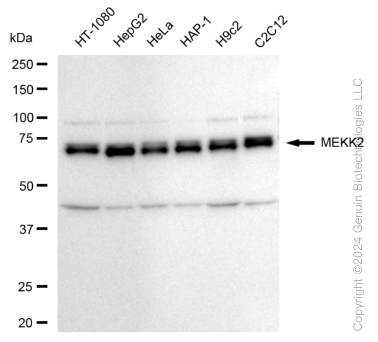 MAP3K2 Rabbit Monoclonal Antibody [Clone ID: 24GB260]