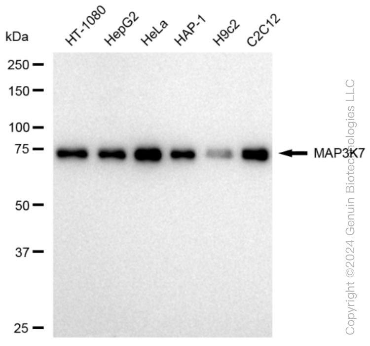MAP3K7 Rabbit Monoclonal Antibody [Clone ID: 23GB2395]