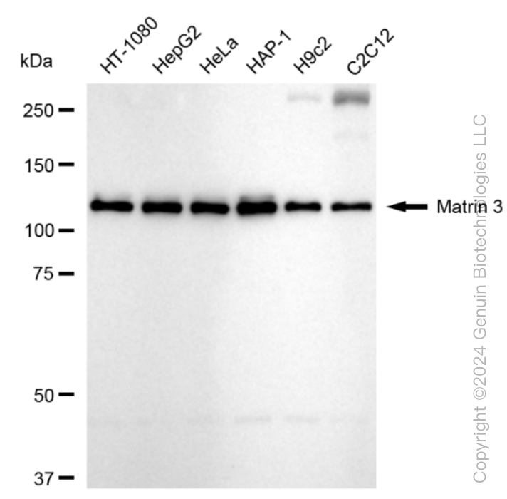 MATR3 Rabbit Monoclonal Antibody [Clone ID: 24GB535]
