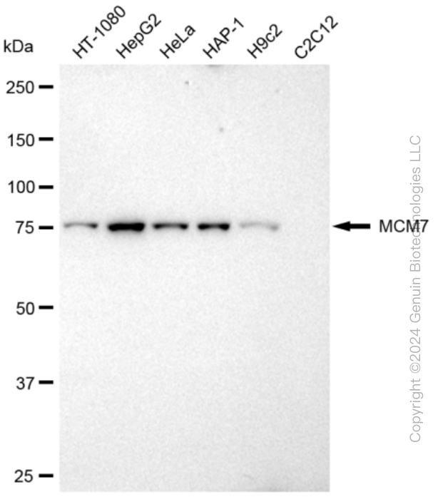 MCM7 Rabbit Monoclonal Antibody [Clone ID: 23GB925]