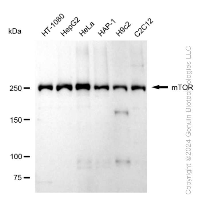 MTOR Rabbit Monoclonal Antibody [Clone ID: 24GB200]
