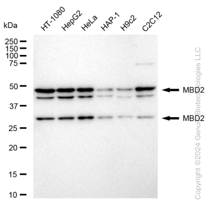 MBD2 Rabbit Monoclonal Antibody [Clone ID: 24GB460]