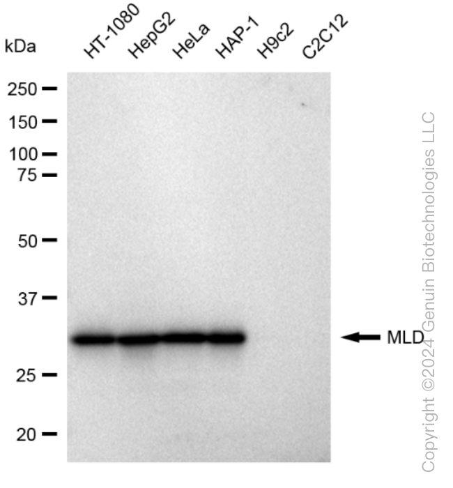 DEGS1 Rabbit Monoclonal Antibody [Clone ID: 23GB1215]