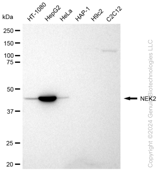 NEK2 Rabbit Monoclonal Antibody [Clone ID: 23GB2085]