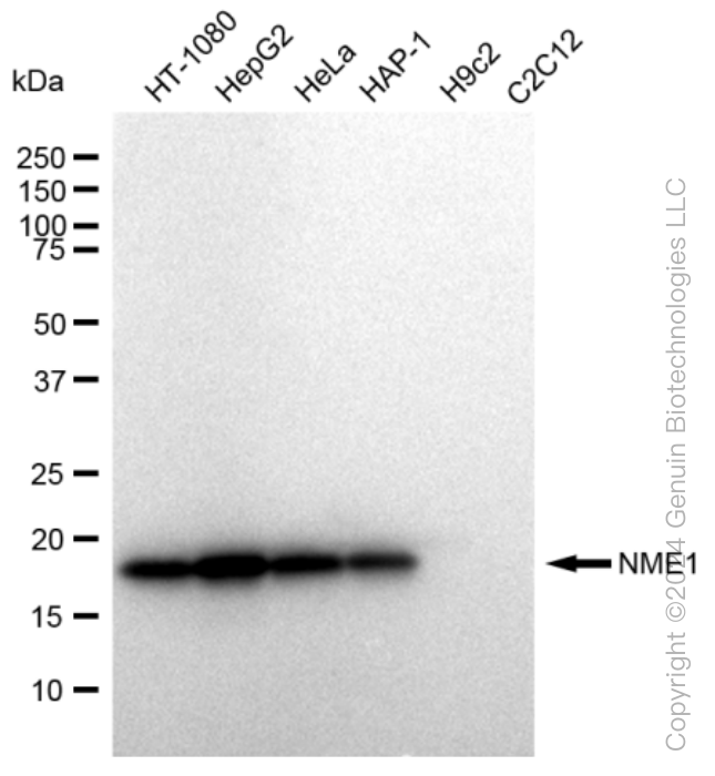 NME1 Rabbit Monoclonal Antibody [Clone ID: 23GB2195]