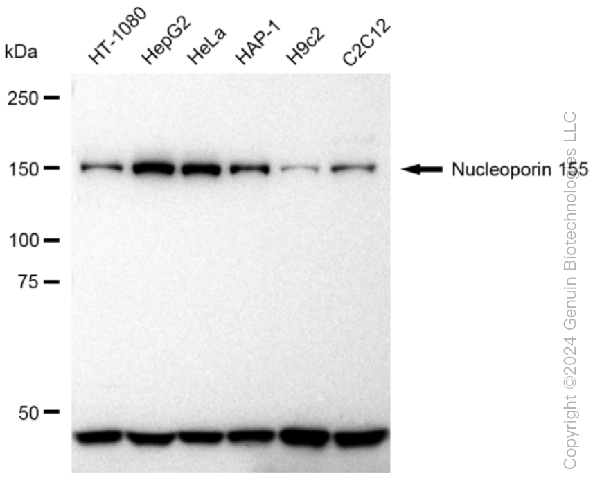 NUP155 Rabbit Monoclonal Antibody [Clone ID: 23GB2010]