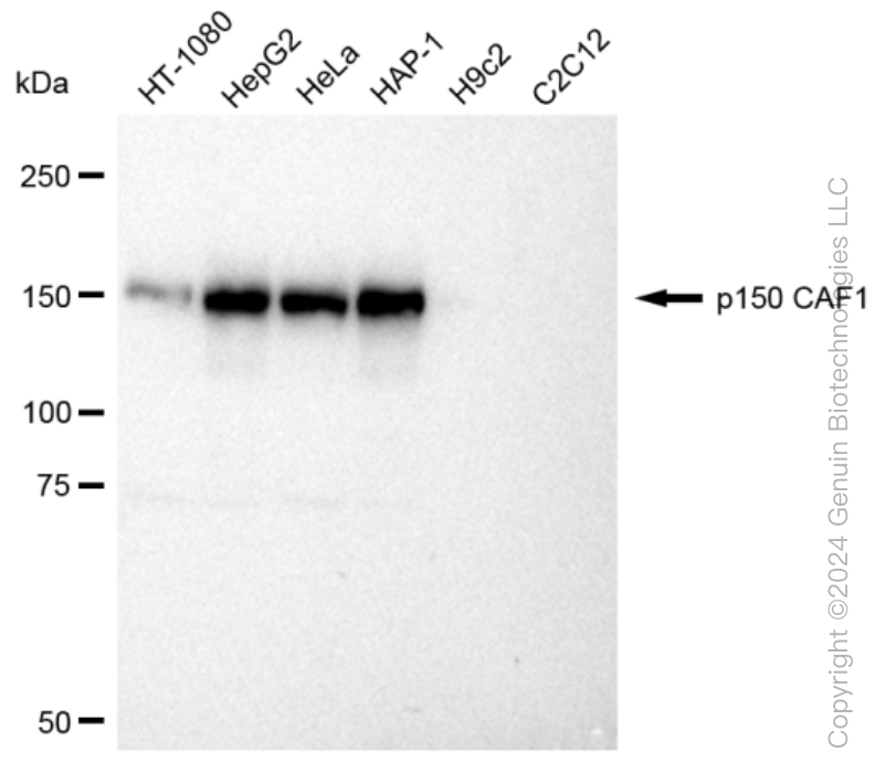 CHAF1A Rabbit Monoclonal Antibody [Clone ID: 23GB1060]