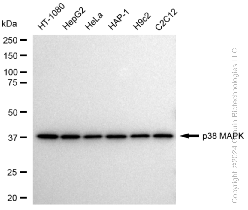 MAPK14 Rabbit Monoclonal Antibody [Clone ID: 23GB4535]