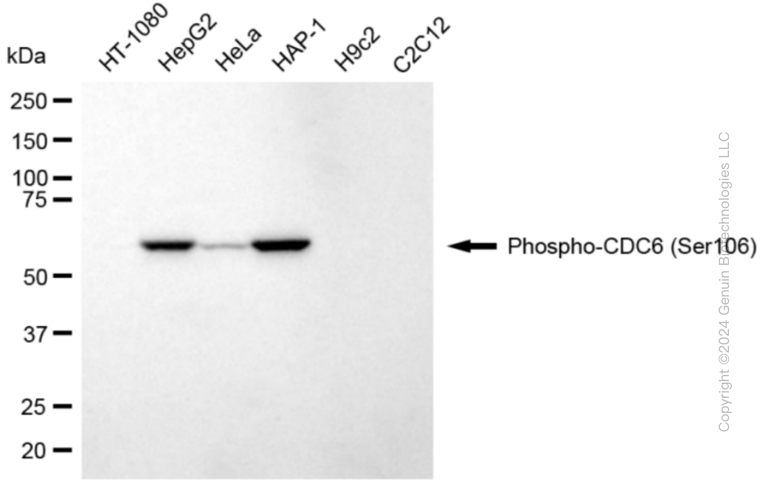 CDC6 Rabbit Monoclonal Antibody [Clone ID: 24GB4770]