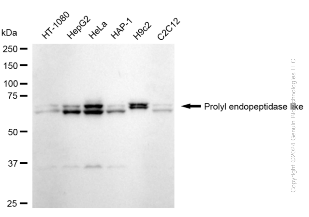 PREPL Rabbit Monoclonal Antibody [Clone ID: 24GB990]