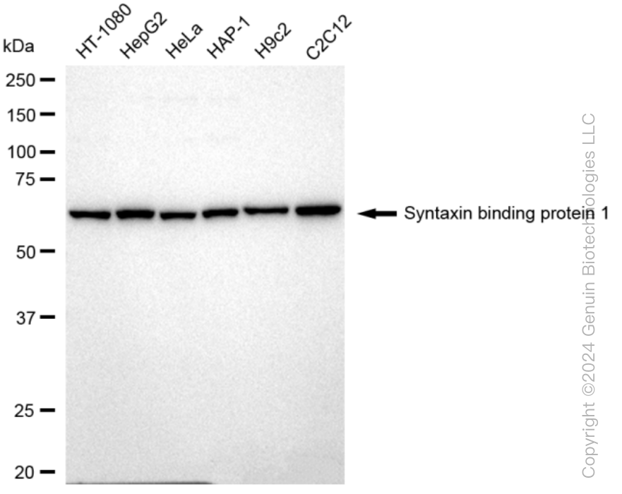 STXBP1 Rabbit Monoclonal Antibody [Clone ID: 23GB2570]