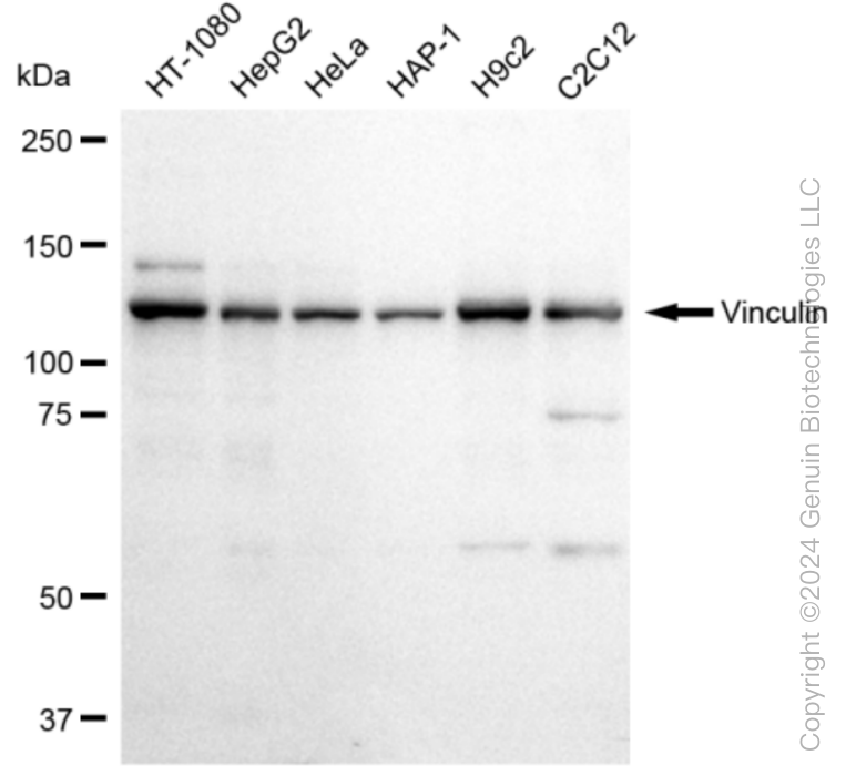 VCL Rabbit Monoclonal Antibody [Clone ID: 23GB2205]