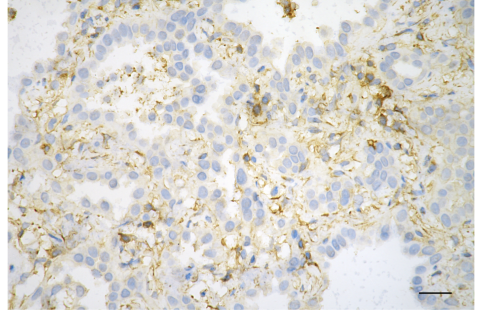 ACTB Rabbit Monoclonal Antibody [Clone ID: 25GB2735]