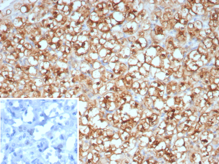 STMN1 Mouse Monoclonal Antibody [Clone ID: STMN1/8438]