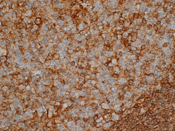 Staining of paraffin embedded human tonsil with Mouse anti Human CD44 (<strong>AM01076PU-N</strong>).
