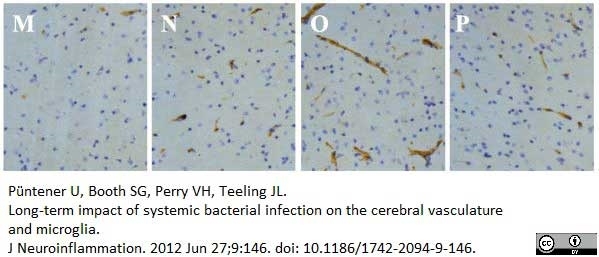 <strong>Published customer image:</strong> <br>Rat anti Mouse CD106 antibody. clone MVCAM A (<strong>AM05557PU-L</strong>) used to evaluate VCAM-1 expression in the murine thalamus by immunohistochemistry on cryostat sections.<br><strong>Image caption:</strong><br>Extract from figure showing VCAM-1 expression.<br>Kinetics of immune marker expression after SL3261 infection. Immune markers of vascular endothelial cells and microglia/macrophages (MHCI (A-D), MHCII (E-H), ICAM-1 (I-L), VCAM-1 (M-P), CD11b (Q-T), and CD68 (U-X)) at 1d (B, F, J, N, R, V), 7d (C, G, K, O, S, W), and 21d (D, H, L, P, T, X) after a systemic challenge with Salmonella typhimurium SL3261 compared to na&iuml;ve non-infected mice (A, E, I, M, Q, U). Representative images from the dorsal lateral geniculate nucleus of the thalamus are shown. Phenotype analysis was carried out with n - 3 mice per time point. Scale bar - 50 &mu;m.<br><br>From: P&uuml;ntener U, Booth SG, Perry VH, Teeling JL.<br>Long-term impact of systemic bacterial infection on the cerebral vasculature and microglia.<br><a href="https://www.ncbi.nlm.nih.gov/pubmed/22738332"target="_blank" rel="noopener">J Neuroinflammation. 2012 Jun 27;9:146</a>.<br>This image is from an open access article distributed under the terms of a <a href="https://creativecommons.org/licenses/by/4.0/"target="_blank" rel="noopener">Creative Commons Attribution License</a>.