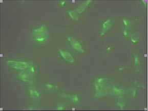 ICC/IF analysis of STEAP1 in LNCap cells. The cell was stained with Human STEAP1 antibody (1:100). The secondary antibody (green) was used Alexa Fluor 488. DAPI was stained the cell nucleus (blue).