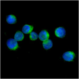 ICC/IF analysis of IL32 in Jurkat cells. The cell was stained with Human IL-32 antibody (1:100). The secondary antibody (green) was used Alexa Fluor 488. DAPI was stained the cell nucleus (blue).