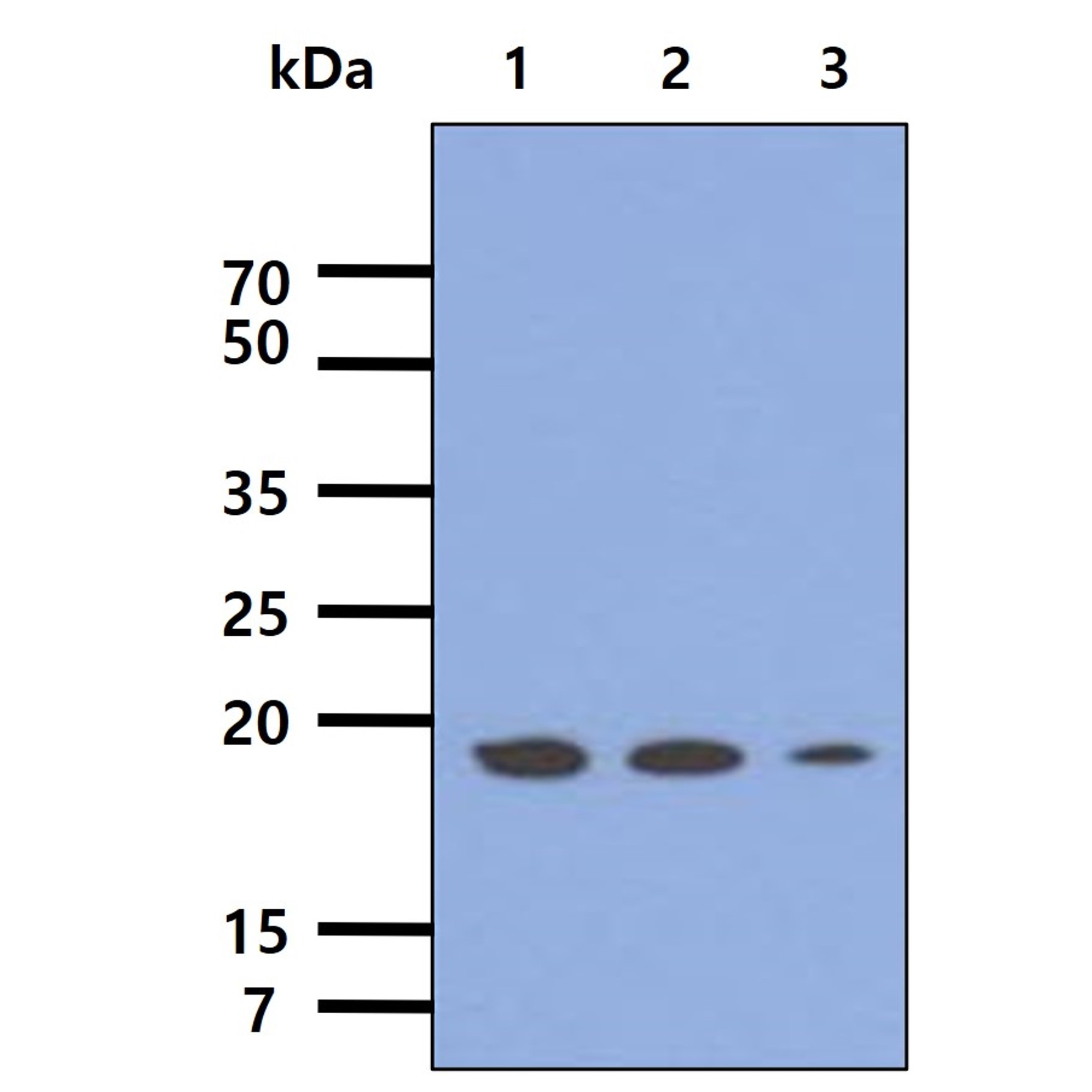 The cell lysates of HepG2 (40ug) were resolved by SDS-PAGE, transferred to PVDF membrane and probed with anti-human MRPS25 antibody. Proteins were visualized using a goat anti-mouse secondary antibody conjugated to HRP and an ECL detection system. Lane 1.: anti-human MRPS25 antibody 1:500 Lane 2.: anti-human MRPS25 antibody 1:1000 Lane 3.: anti-human MRPS25 antibody 1:5000