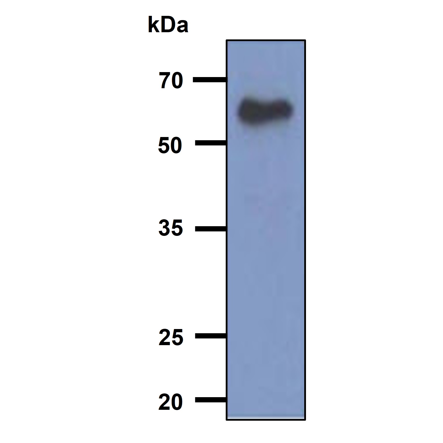 The cell lysates of Jurkat (40ug) were resolved by SDS-PAGE, transferred to PVDF membrane and probed with anti-human RANBP3 antibody (1:500). Proteins were visualized using a goat anti-mouse secondary antibody conjugated to HRP and an ECL detection system.