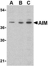 Western blot analysis of whole cell lysates from Raji human Burkitt's lymphoma cells probed with Rabbit anti Human CD5L, also known as AIM (<strong>AP05583PU-N</strong>) at 0.5(A), 1(B) and 2(C) ug/ml.