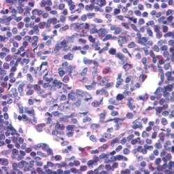 Staining of human lymph node tissue with Rabbit anti Human CCR5 (NT) at 20 µg/ml. Formalin fixed paraffin processed tissue. (<strong>AHP588</strong>)