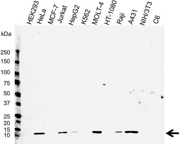 Western blot analysis of whole cell lysates probed withMouse anti Human beta 2 microglobulin antibody, clone 2213 (<strong>BM603</strong>) followed by detection with HRP conjugated Goat anti Mouse IgG (1/10,000, <a href="https://www.bio-rad-antibodies.com/mouse-igg-antibody-star207p.html">STAR207P</a>) and visualized on the ChemiDoc MP with 166 second exposure, Arrow points to beta 2 microglobulin (molecular weight 12 kDa).