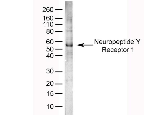 Human brain lysate probed with Sheep anti Human Neuropeptide Y Receptor 1 antibody (<strong>BP653</strong>).