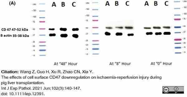 <strong>Published customer image:</strong> <br>Mouse anti Human CD47 antibody, clone BRIC126 (<strong>SM1120P</strong>) used to assess levels of CD47 expression in serum samples from pigs by western blotting.<br><strong>Image caption:</strong><br>(A) Western blot of CD47 from each group at different time hours <br><br>From: Wang Z, Guo H, Xu R, Zhao CN, Xia Y.<br>The effects of cell surface CD47 downregulation on ischaemia-reperfusion injury during pig liver transplantation.<br><a href="https://pubmed.ncbi.nlm.nih.gov/33881787/"target="_blank" rel="noopener">Int J Exp Pathol. 2021 Jun;102(3):140-7</a>.<br>doi: 10.1111/iep.12391.<br>This image is from an open access article distributed under terms of a <a href="https://creativecommons.org/licenses/by/4.0/"target="_blank" rel="noopener">Creative Commons Attribution License</a>.