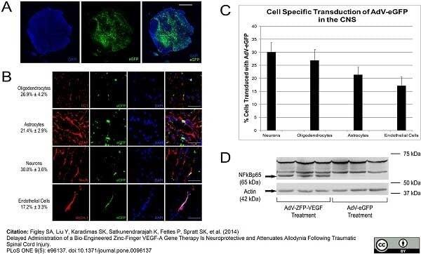 <strong>Published customer image:</strong> <br>Mouse anti Rat RECA-1 antibody, clone HIS52 (<strong>MCA970R</strong>) used for the detection of RECA-1 expressing cells by immunofluorescence.<br><strong>Image caption</strong><br>Transduction of AdV-eGFP/AdV-ZFP-VEGF into the spinal cord. (A) Photomicrographs showing a transverse section of rat spinal cord obtained adjacent to the injury site 10 days after spinal cord injury and AdV-eGFP injection. eGFP signal was detected in both the gray matter and white matter. (B) High-power (63X) confocal images show that the AdV-eGFP vector (green) transfected neurons (NeuN), astrocytes (GFAP), oligodendrocytes (CC1) and endothelial cells (RECA-1). Cells have been counter-stained with DAPI (blue) as nuclear marker. (C) Bar graph displays quantification of transduced cell types ± SEM, as identified by the cell-specific markers NeuN, GFAP, RECA-1 and CC1. (D) Evaluation of AdV-ZFP-VEGF gene transfer. Western blot showed that the NF&kappa;B p65 rabbit polyclonal antibody recognizes the p65 activation domain in the AdV-ZFP-VEGF treated animals. The higher molecular weight bands are endogenous NF&kappa;Bp65 fragments, which are also recognized by the antibody; however, these bands are present in both the control and treatment groups. The lower band (arrow) corresponds to the AdV-ZFP-VEGF and was only present in the treated animals. Lower panel shows actin expression as a protein control. Scale bar: 1000 &mu;m for A; 100 &mu;m for B.<br><br>From:  Figley SA, Liu Y, Karadimas SK, Satkunendrarajah K, Fettes P, <em>et al</em>. <br>Delayed Administration of a Bio-Engineered Zinc-Finger VEGF-A Gene Therapy Is Neuroprotective and Attenuates Allodynia Following Traumatic Spinal Cord Injury.<br><strong><a href="https://www.ncbi.nlm.nih.gov/pubmed/24846143"target="_blank" rel="noopener">PLoS ONE (2014) 9(5): e96137</a></strong>.<br>doi: 10.1371/journal.pone.0096137.<br>This image is from an open access article distributed under terms of a <a href="https://creativecommons.org/licenses/by/4.0/"target="_blank" rel="noopener">Creative Commons Attribution License</a>.