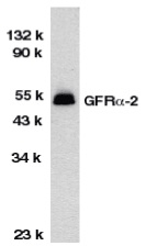 Western blot analysis of HeLa total cell lysate probed with Rabbit anti Human GFR alpha 2 (<strong>SP2103P</strong>).