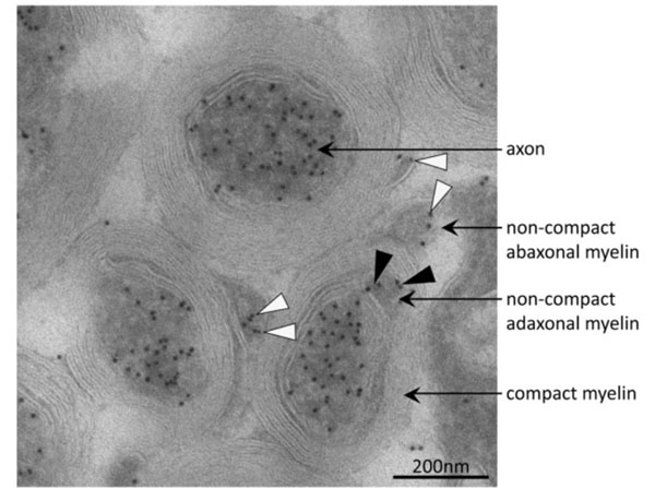 Immuno-electron micrograph detecting acetylated α-tubulin in axons and non-compact myelin. Acetylated microtubules were abundant in axons of mouse optic nerve as indicated by immuno-gold particles (black dots). In the adaxonal and abaxonal non-compact myelin compartment, acetylated microtubules were also present. Black and white arrow-heads point to corresponding immuno-gold particles in adaxonal and abaxonal non-compact myelin, respectively. On compact myelin, no immuno-gold was observed. Immunogold labeling of cryosections was performed on optic nerves of postnatal day 75. Antibody was specific for acetylated α-tubulin (1:1000) and was detected by incubation with rabbit anti-mouse IgG secondary antiserum (1:200 p/n TA396598) which was visualized with protein A-gold (10 nm).  Figure 4. PMID: 28248254.