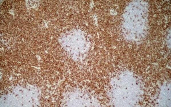 Mouse IgG1 Goat Polyclonal Antibody