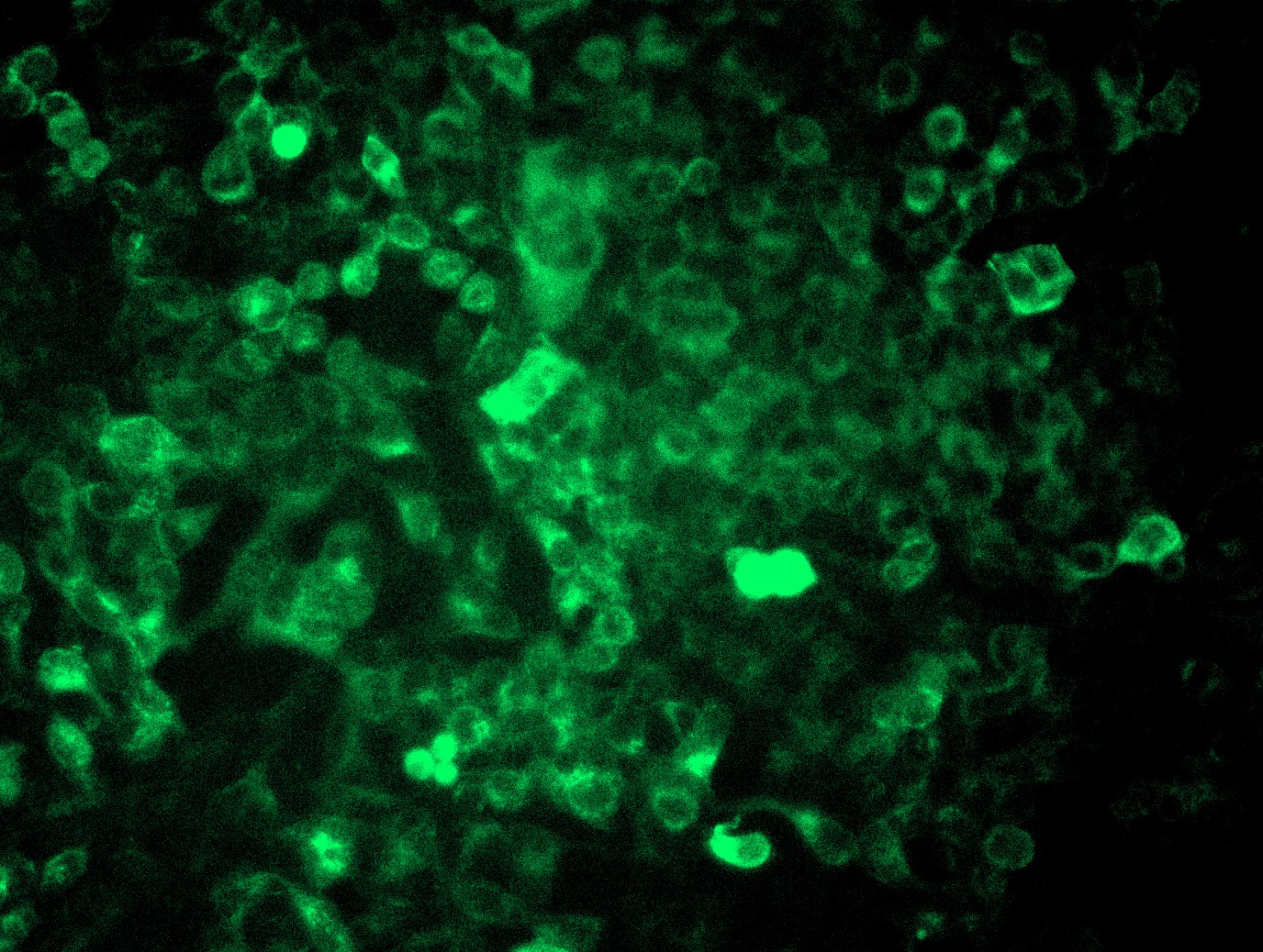 Hek293 cells were transduced with human IGF1 AAV particles (MOI 500,000). After 72 hours, DDK expression was analyzed.