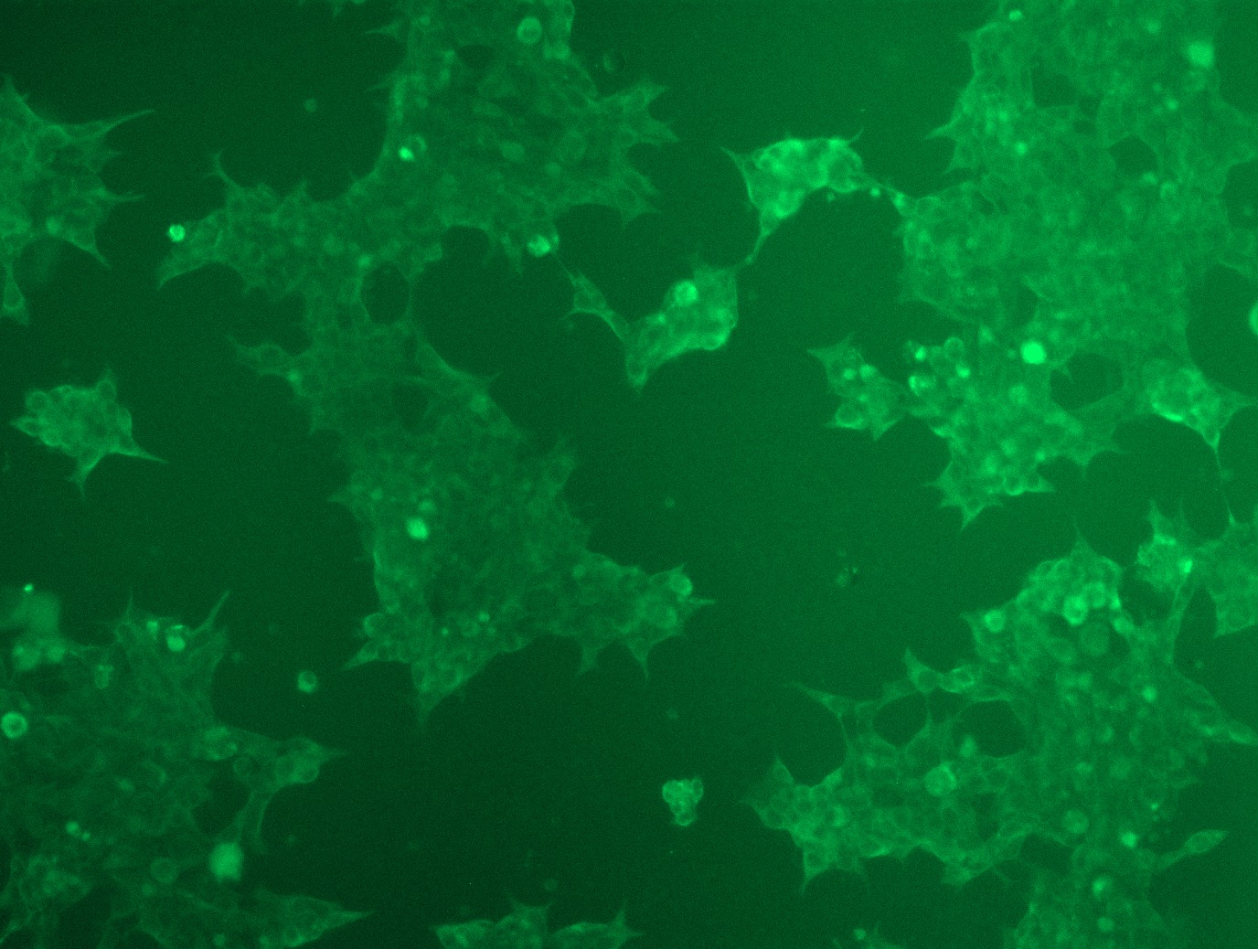 MR207139L3 was used to prepare Lentiviral particles using TR30037 packaging kit. HEK293T cells were transduced with MR207139L3V particle to overexpress human Fads1-Myc-DDK fusion protein.