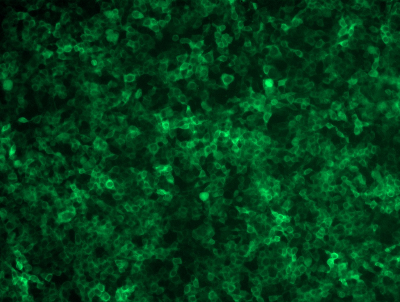 <a href = "https://www.origene.com/catalog/cdna-clones/expression-plasmids/mr219119l2-cbs-nm-144855-mouse-tagged-lenti-orf-clone" title="MR219119L2" class="">MR219119L2</a> was used to prepare Lentiviral particles using <a href = "https://www.origene.com/catalog/others/lentiviral-packaging-kits/tr30037-lentiviral-packaging-kits" title="TR30037" class="">TR30037</a> packaging kit. HEK293T cells were transduced with MR219119L2V particle to overexpress human Cbs-mGFP fusion protein.