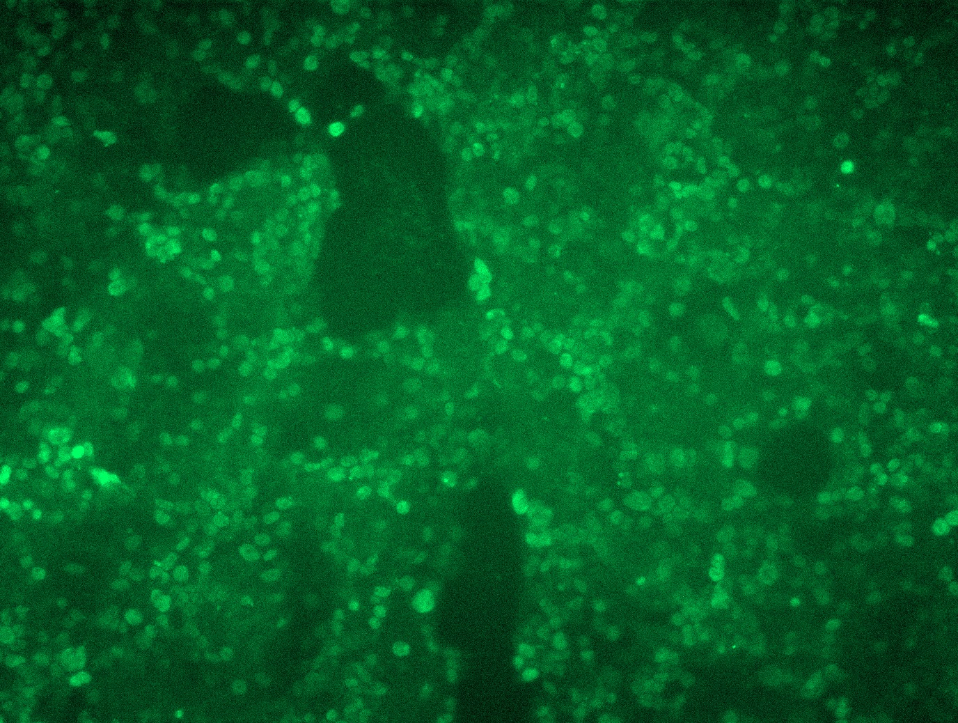 <a href = "https://www.origene.com/catalog/cdna-clones/expression-plasmids/mr222596l3-prdm16-nm-027504-mouse-tagged-lenti-orf-clone" title="MR222596L3" class="">MR222596L3</a> was used to prepare Lentiviral particles using <a href = "https://www.origene.com/catalog/others/lentiviral-packaging-kits/tr30037-lentiviral-packaging-kits" title="TR30037" class="">TR30037</a> packaging kit. HEK293T cells were transduced with MR222596L3V particle to overexpress human Prdm16-Myc-DDK fusion protein.