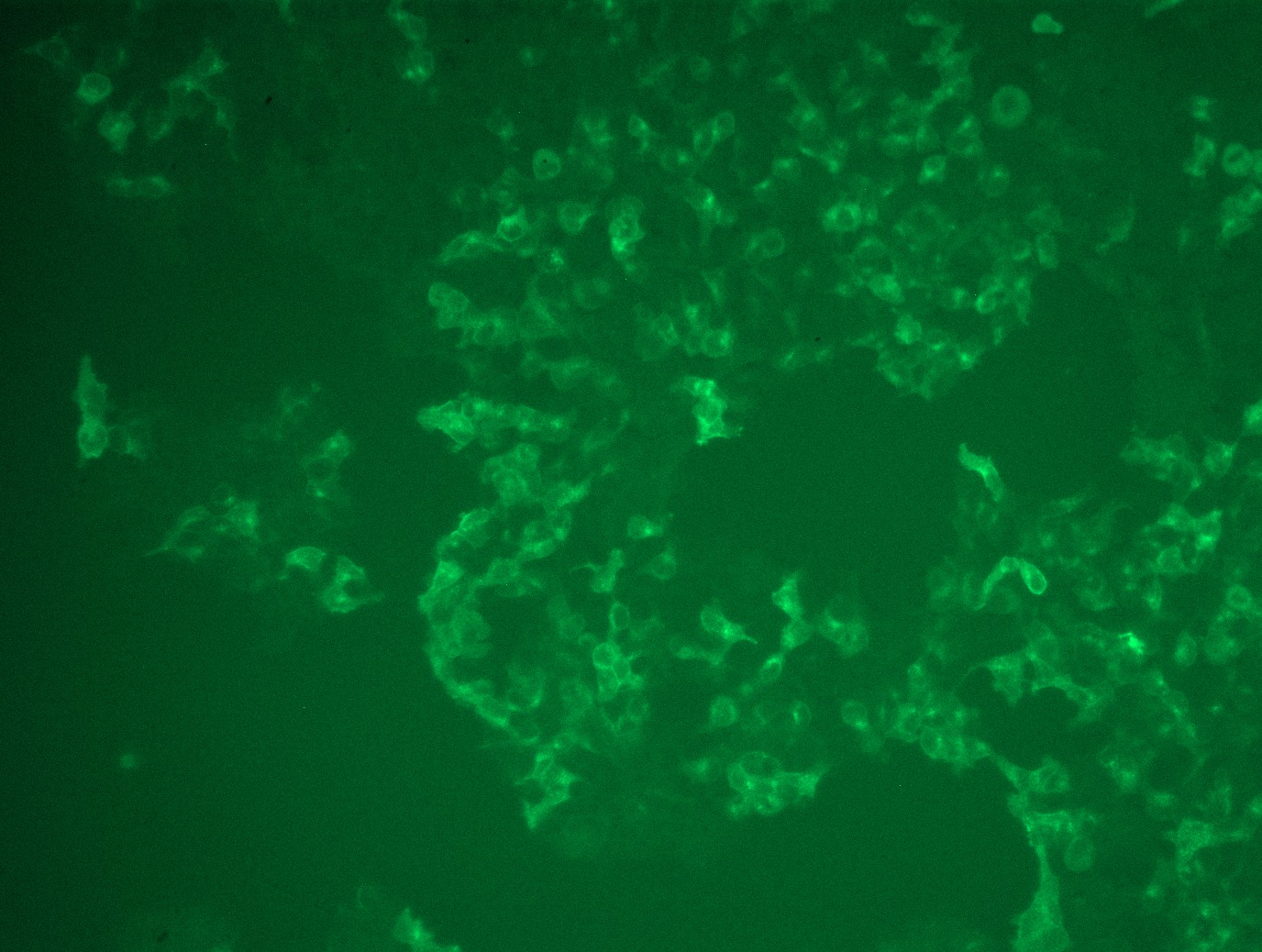 <a href = "https://www.origene.com/catalog/cdna-clones/expression-plasmids/mr227101l3-kl-nm-013823-mouse-tagged-lenti-orf-clone" title="MR227101L3" class="">MR227101L3</a> was used to prepare Lentiviral particles using <a href = "https://www.origene.com/catalog/others/lentiviral-packaging-kits/tr30037-lentiviral-packaging-kits" title="TR30037" class="">TR30037</a> packaging kit. HEK293T cells were transduced with MR227101L3V particle to overexpress human Kl-Myc-DDK fusion protein.