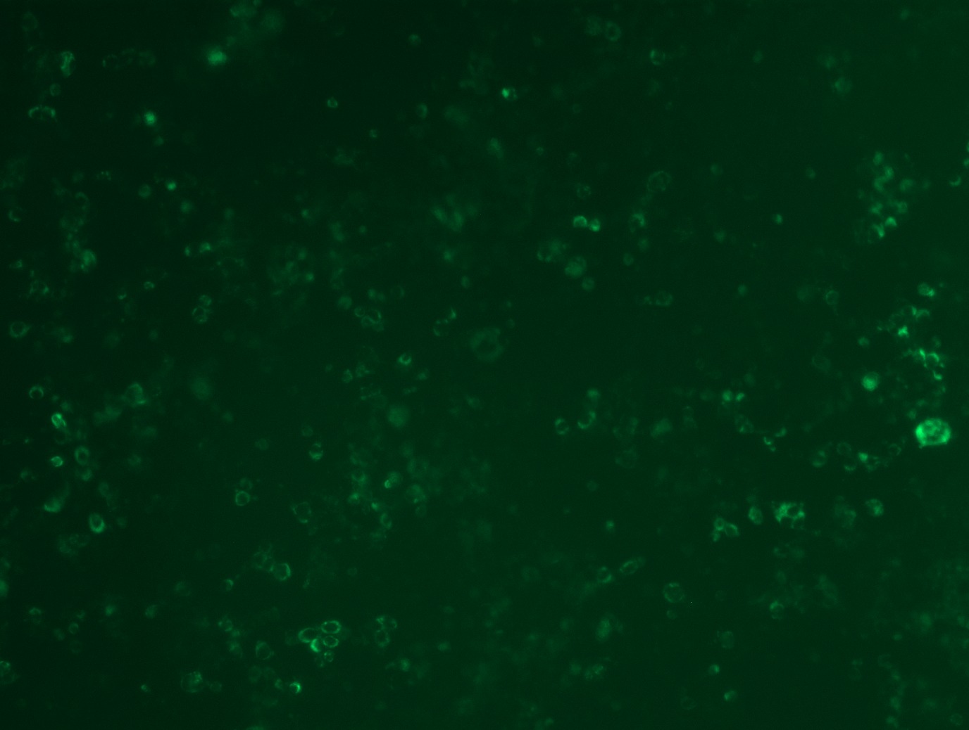 <a href = "https://www.origene.com/catalog/cdna-clones/expression-plasmids/rc200006l4-ldl-receptor-ldlr-nm-000527-human-tagged-lenti-orf-clone" title="RC200006L4" class="">RC200006L4</a> was used to prepare Lentiviral particles using <a href = "https://www.origene.com/catalog/others/lentiviral-packaging-kits/tr30037-lentiviral-packaging-kits" title="TR30037" class="">TR30037</a> packaging kit. HEK293T cells were transduced with RC200006L4V particle to overexpress human LDLR-mGFP fusion protein.