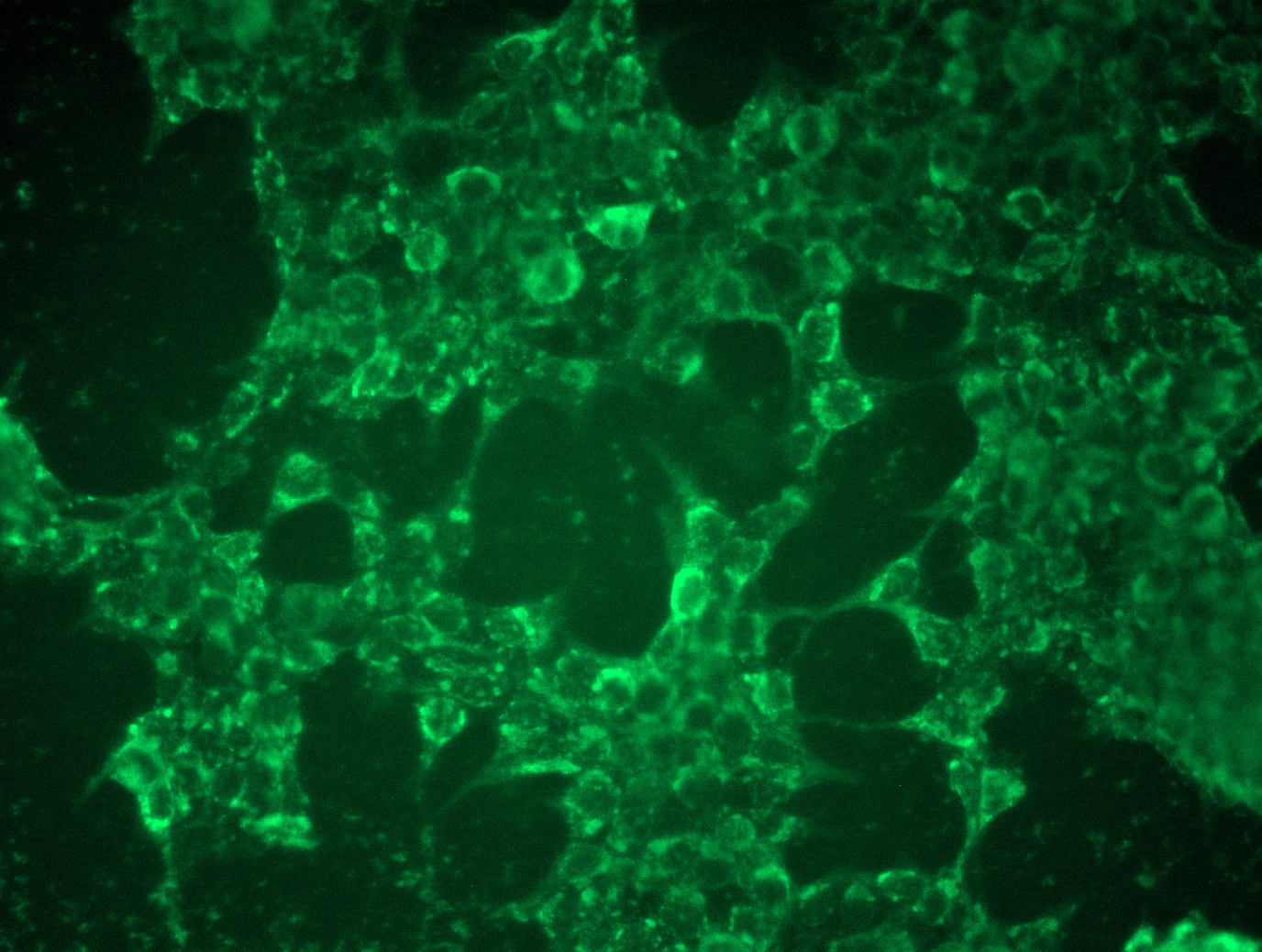 <a href = "https://www.origene.com/catalog/cdna-clones/expression-plasmids/rc200395l3-apolipoprotein-e-apoe-nm-000041-human-tagged-lenti-orf-clone" title="RC200395L3" class="">RC200395L3</a> was used to prepare Lentiviral particles using <a href = "https://www.origene.com/catalog/others/lentiviral-packaging-kits/tr30037-lentiviral-packaging-kits" title="TR30037" class="">TR30037</a> packaging kit. HEK293T cells were transduced with RC200395L3V particle to overexpress human APOE-Myc-DDK fusion protein.