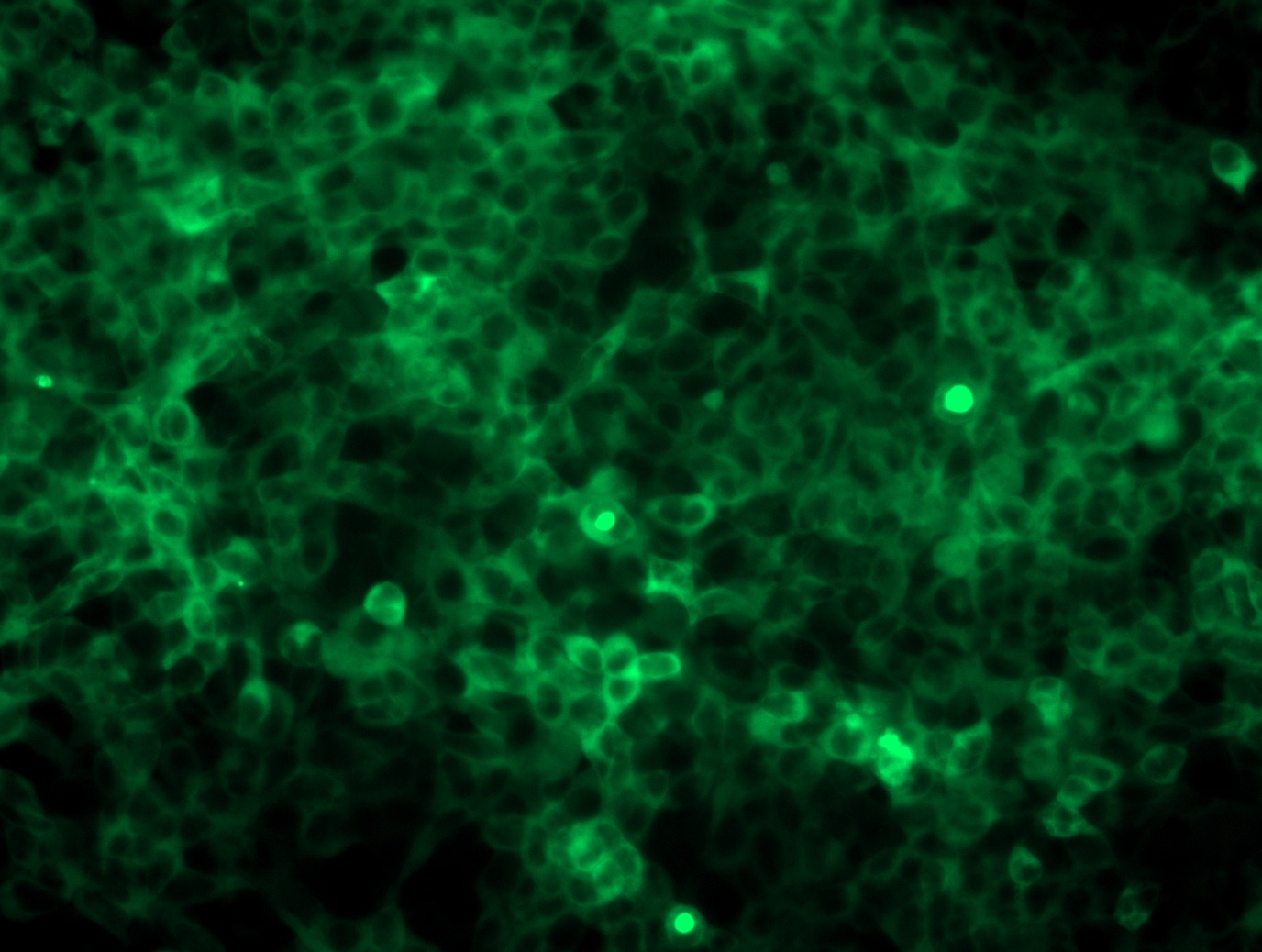 <a href = "https://www.origene.com/catalog/cdna-clones/expression-plasmids/rc200477l4-foxo1-nm-002015-human-tagged-lenti-orf-clone" title="RC200477L4" class="">RC200477L4</a> was used to prepare Lentiviral particles using <a href = "https://www.origene.com/catalog/others/lentiviral-packaging-kits/tr30037-lentiviral-packaging-kits" title="TR30037" class="">TR30037</a> packaging kit. HEK293T cells were transduced with RC200477L4V particle to overexpress human FOXO1-mGFP fusion protein.