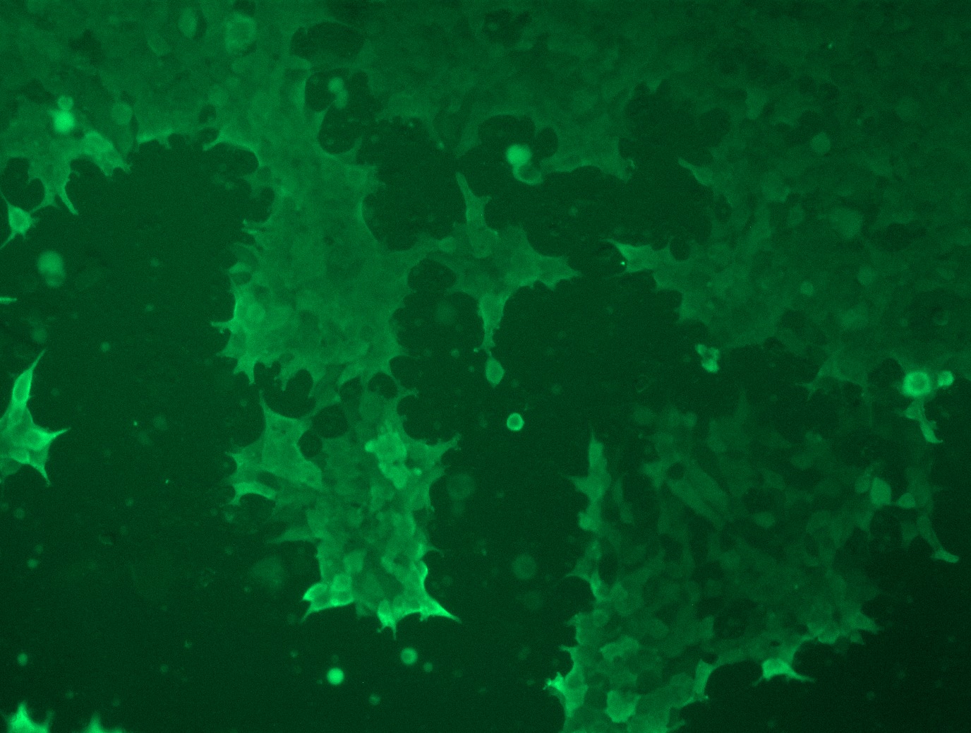 <a href = "https://www.origene.com/catalog/cdna-clones/expression-plasmids/rc200725l1-superoxide-dismutase-1-sod1-nm-000454-human-tagged-lenti-orf-clone" title="RC200725L1" class="">RC200725L1</a> was used to prepare Lentiviral particles using <a href = "https://www.origene.com/catalog/others/lentiviral-packaging-kits/tr30037-lentiviral-packaging-kits" title="TR30037" class="">TR30037</a> packaging kit. HEK293T cells were transduced with RC200725L1V particle to overexpress human SOD1-Myc-DDK fusion protein.