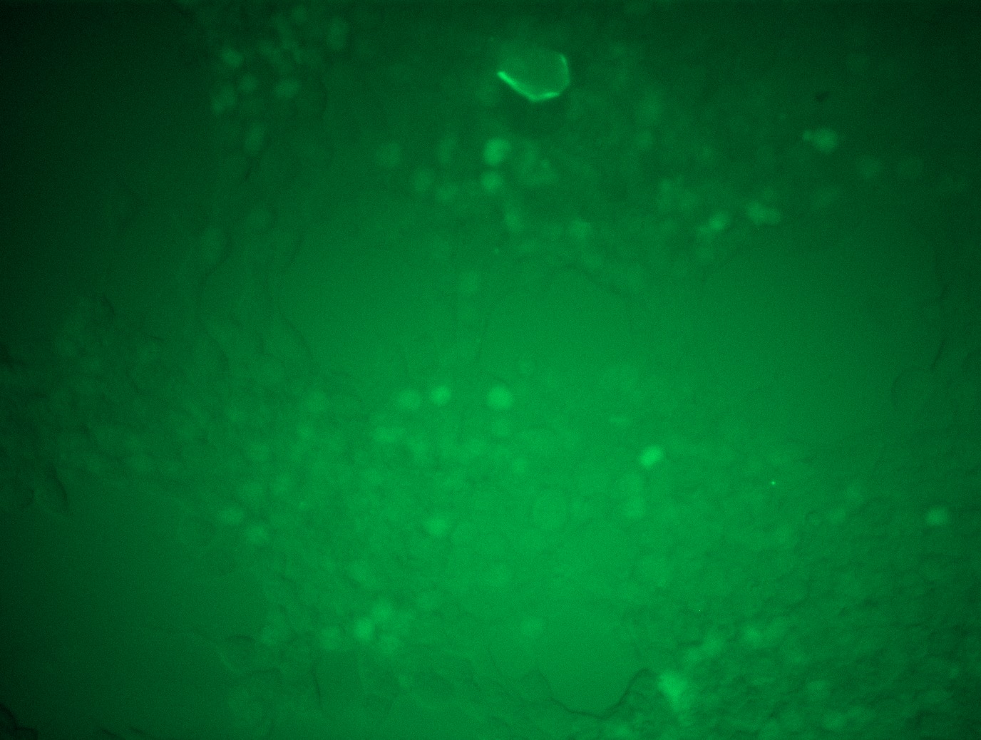 <a href = "https://www.origene.com/catalog/cdna-clones/expression-plasmids/rc201123l2-ascl1-nm-004316-human-tagged-lenti-orf-clone" title="RC201123L2" class="">RC201123L2</a> was used to prepare Lentiviral particles using <a href = "https://www.origene.com/catalog/others/lentiviral-packaging-kits/tr30037-lentiviral-packaging-kits" title="TR30037" class="">TR30037</a> packaging kit. HEK293T cells were transduced with RC201123L2V particle to overexpress human ASCL1-mGFP fusion protein.